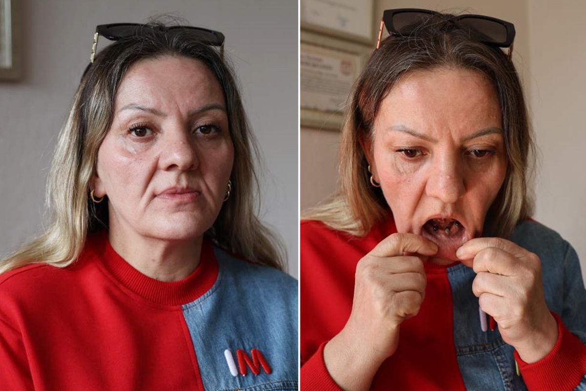 Diş ağrısı şikayetiyle doktora giden hasta, 25 dişinin çekilmesiyle sonuçlanan bir operasyon geçirdi.