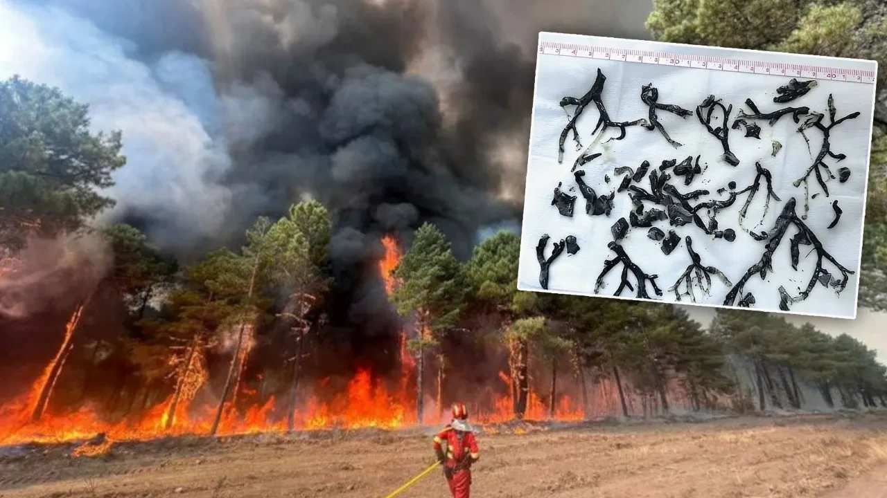 Duman Soluyan 87 Yaşındaki Hastanın Akciğerlerinden “Dal Benzeri” Yapılar Çıktı